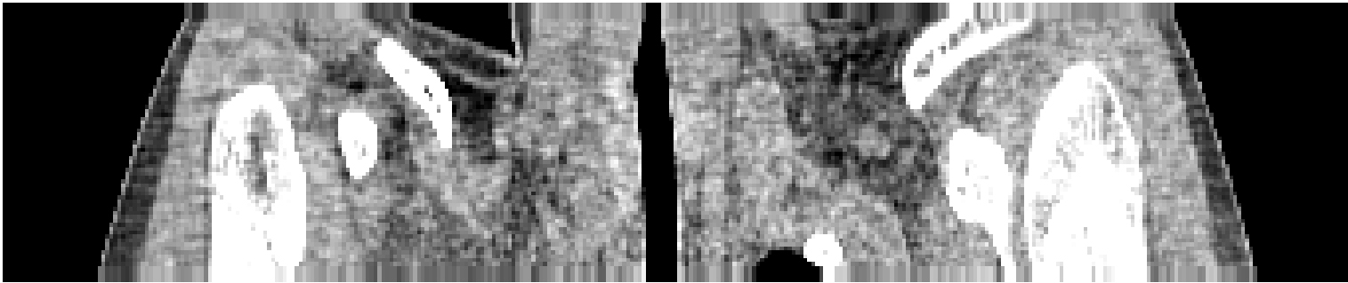 An image slice from a traditional CT scan of a patient's lungs. Credit: Jeffrey Fessler