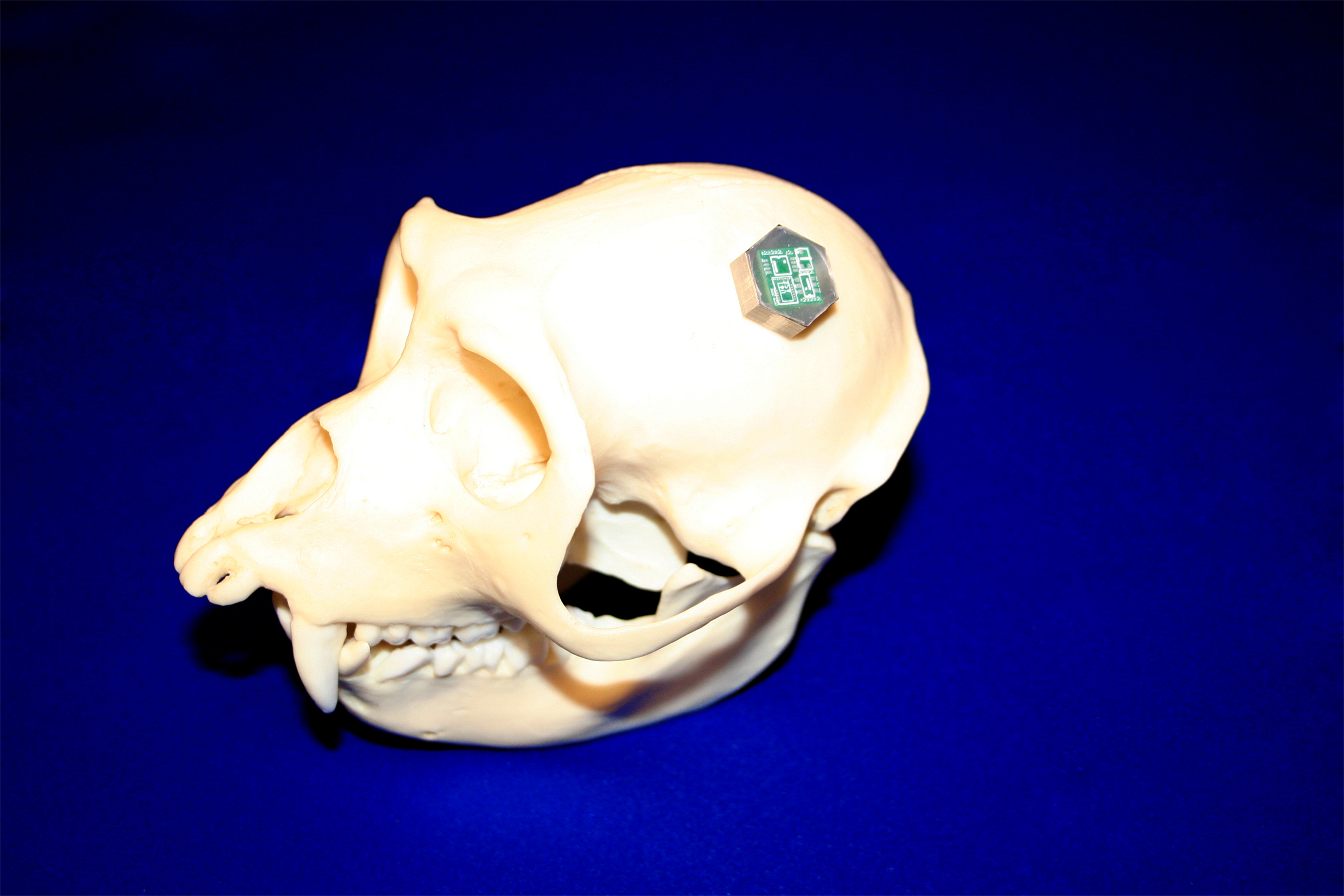 Photo provided by Euisik Yoon of University of Michigan