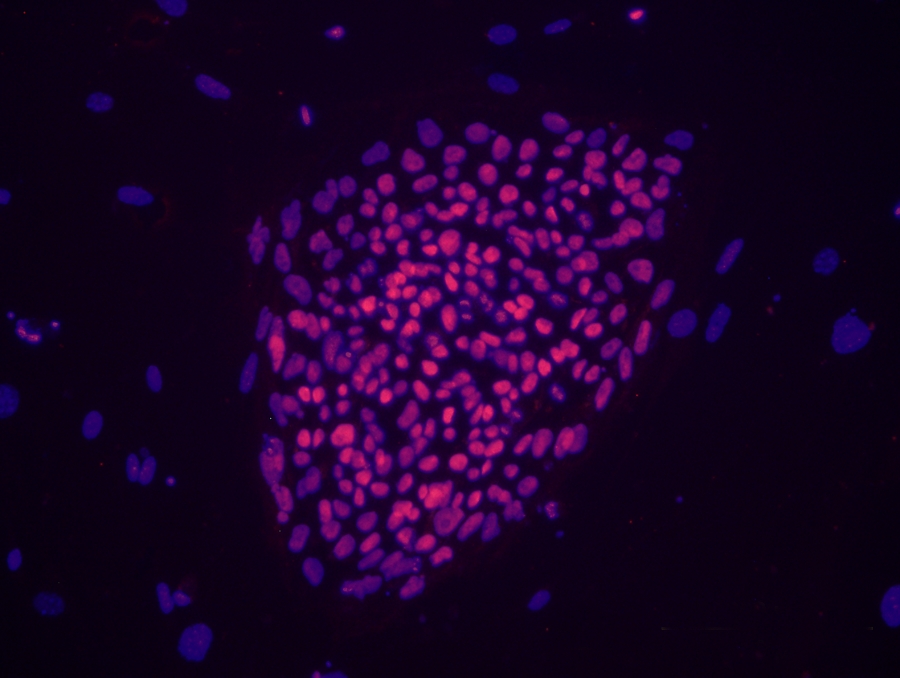 A microscope image showing a colony of induced pluripotent stem cells created by the U-M Consortium for Stem Cell Therapies. Photo courtesy of Sue O'Shea.