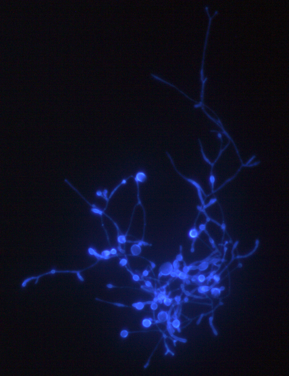 Description: Culture stained to make cell walls visible. Hyphae (long, branching filamentous structure) and swellings (clamydospores) are visible. Credit: Evan Dougherty