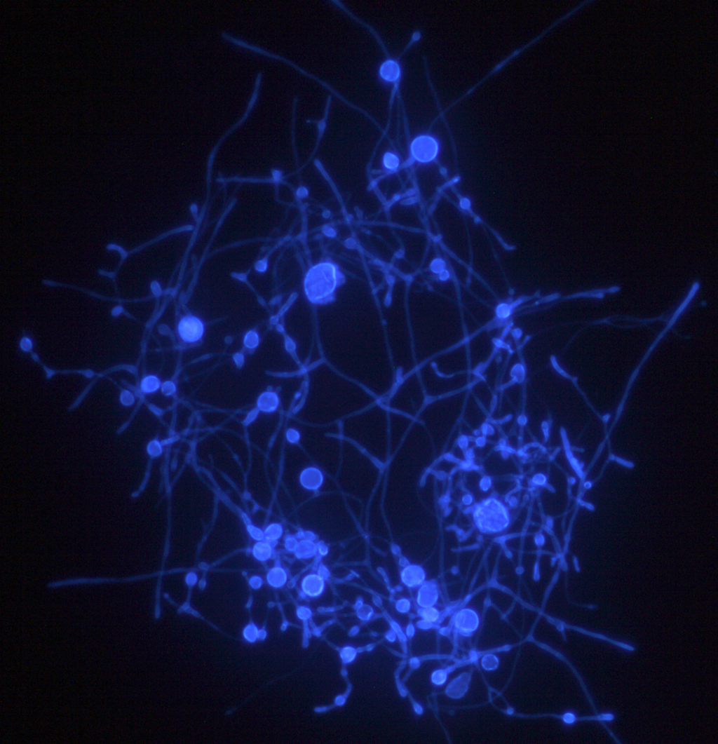 Culture stained to make cell walls visible. Hyphae (long, branching filamentous structure) and swellings (clamydospores) are visible. Credit: Audrius Menkis