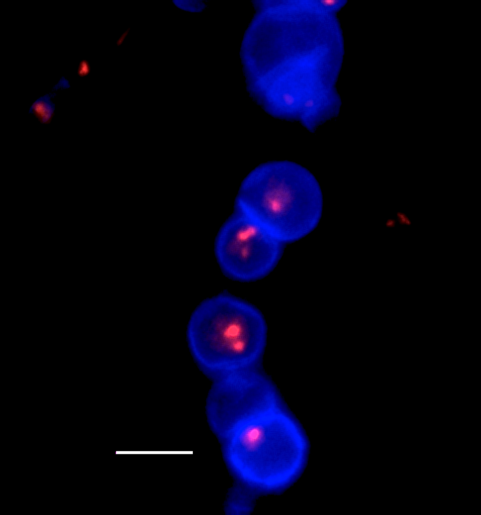 Culture stained to make cell walls and nuclei visible. The swellings contain nuclei and are thought to be similar to clamydospores -- thick-walled, asexual resting spores of certain fungi. Credit: Timothy James