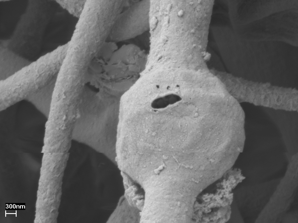 SEM (scanning electron microscopy) image of fixed culture. A swelling has cracked and looks like a face. Scale: 300 nm Credit: Anna Rosling & Karelyn Cruz Martinez