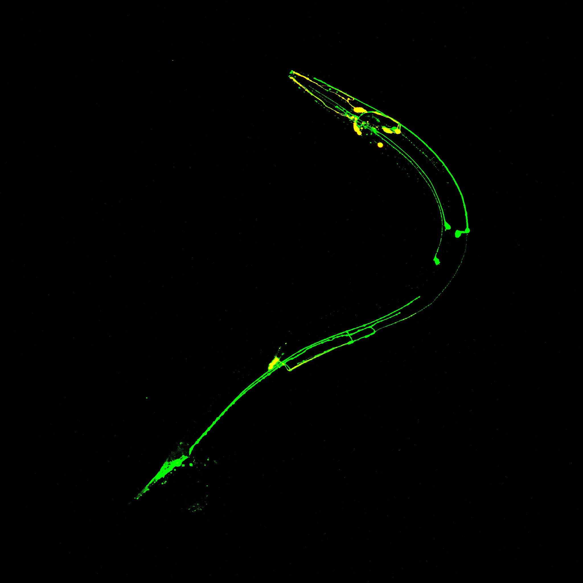 Green and yellow fluorescence mark the processes and cell bodies of some C. elegans neurons. Image courtesy of the Xu lab.