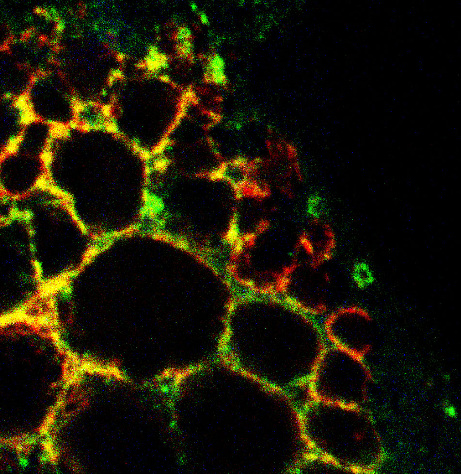 This microscope image shows many enlarged lysosomes inside a mouse skin cell. Lysosomes are the cell's recycling centers. Image credit: Xiang Wang and Haoxing Xu, University of Michigan.