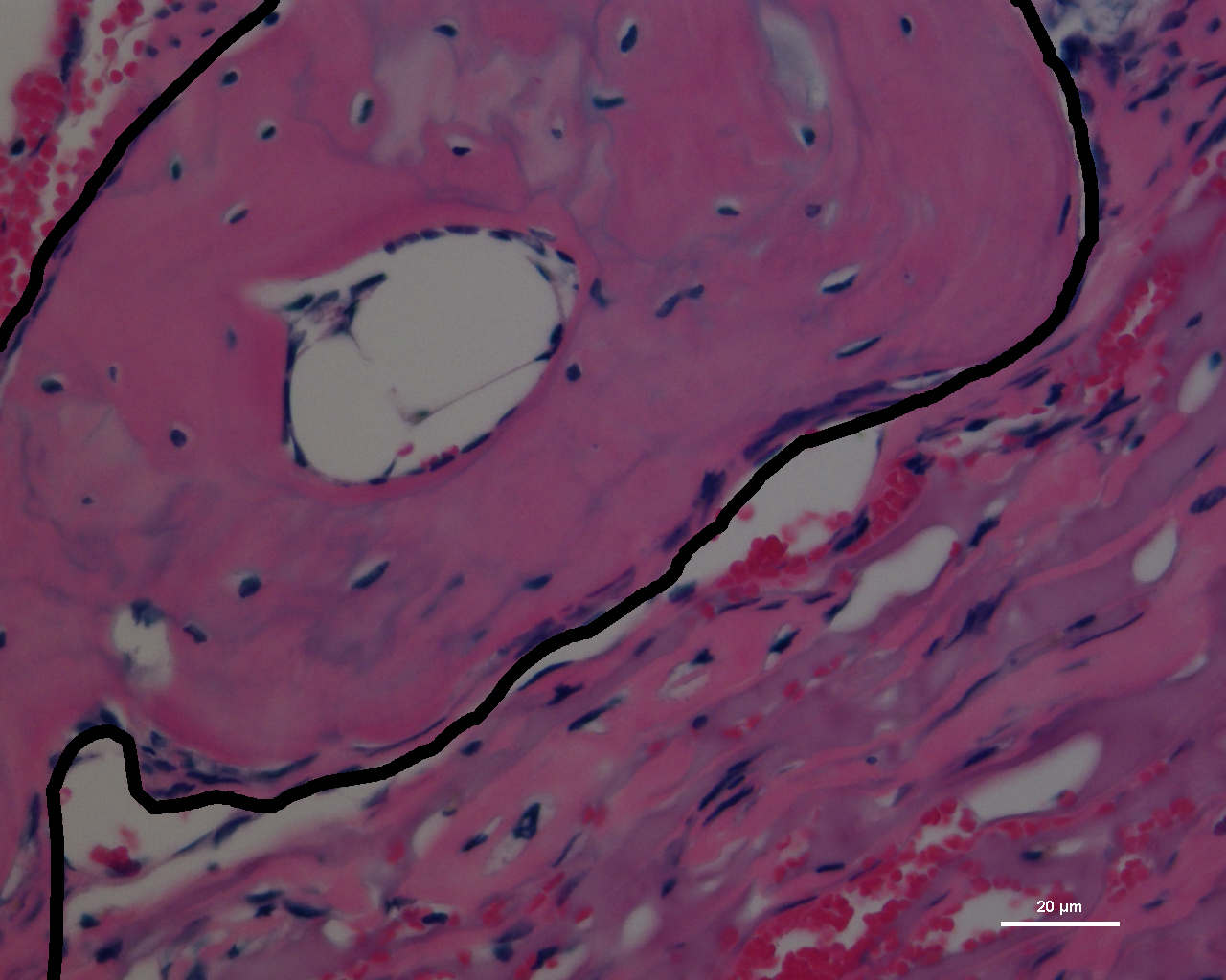On a special surface that could help advance stem cell therapies, U-M researchers have turned human skin cells into adult-derived stem cells, coaxed them into bone cells and then transplanted them into holes in the skulls of mice. The cells produced four times as much new bone growth as in the mice without the extra bone cells. In this pink-stained image, the black outline partially encloses the new bone growth in the skull. Image credit: Villa-Diaz, L.G., Brown, S.E., Liu, Y. Ross, A.M., Lahann, J.M., Krebsbach, P.H., University of Michigan