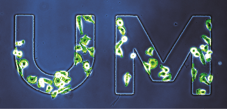 This false-color microscopic image shows cancer cells selectively adhering to patterned nanorough letters (UM) on a glass surface. Image credit: Weiqiang Chen