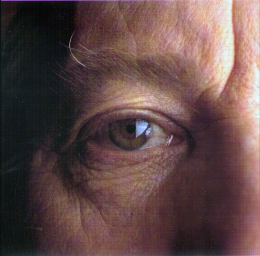 A close-up crop of an eye surrounded by wrinkles. Image credit: National Eye Institute, National Institutes of Health