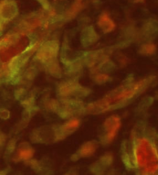 Engineered blood vessels built with lung fibroblasts as supporting structure cells were leaky, as this image depicts. Red represents the tracer dye the researchers injected into the bloodstream of mice. The tracer dye does is not contained in vessels. The researchers captured this image 14 days after the experiment began. Image credit: Stephanie Grainger