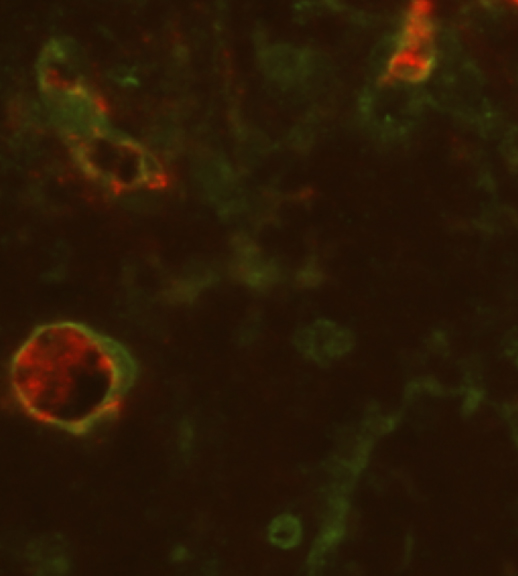Engineered blood vessels built with adult stem cells from fat were more robust and better able to hold blood inside them. Red represents the tracer dye the researchers injected into the bloodstream of mice. The researchers captured this image 14 days after the experiment began. Photo credit: Stephanie Grainger