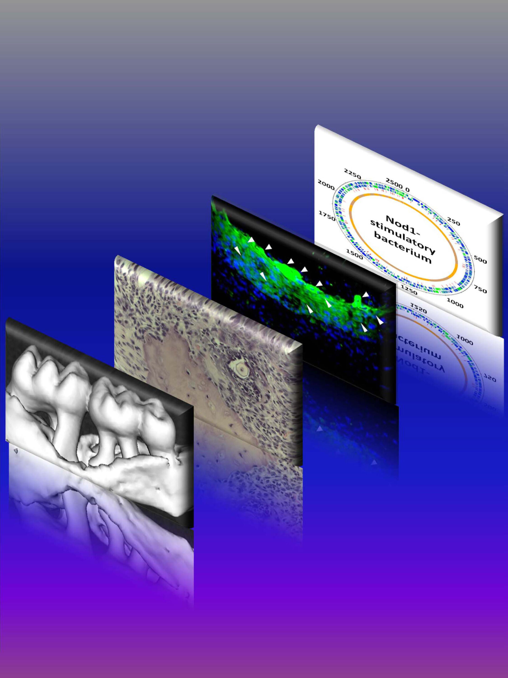 From front to back: The steps involved in discovering the bone loss bacteria, which stimulates the normally protective immune response to cause even more bone loss.