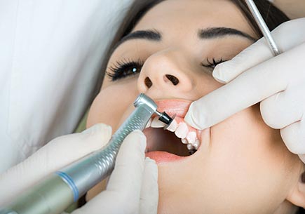 Young woman getting her teeth cleaned at the dentist. (stock image)