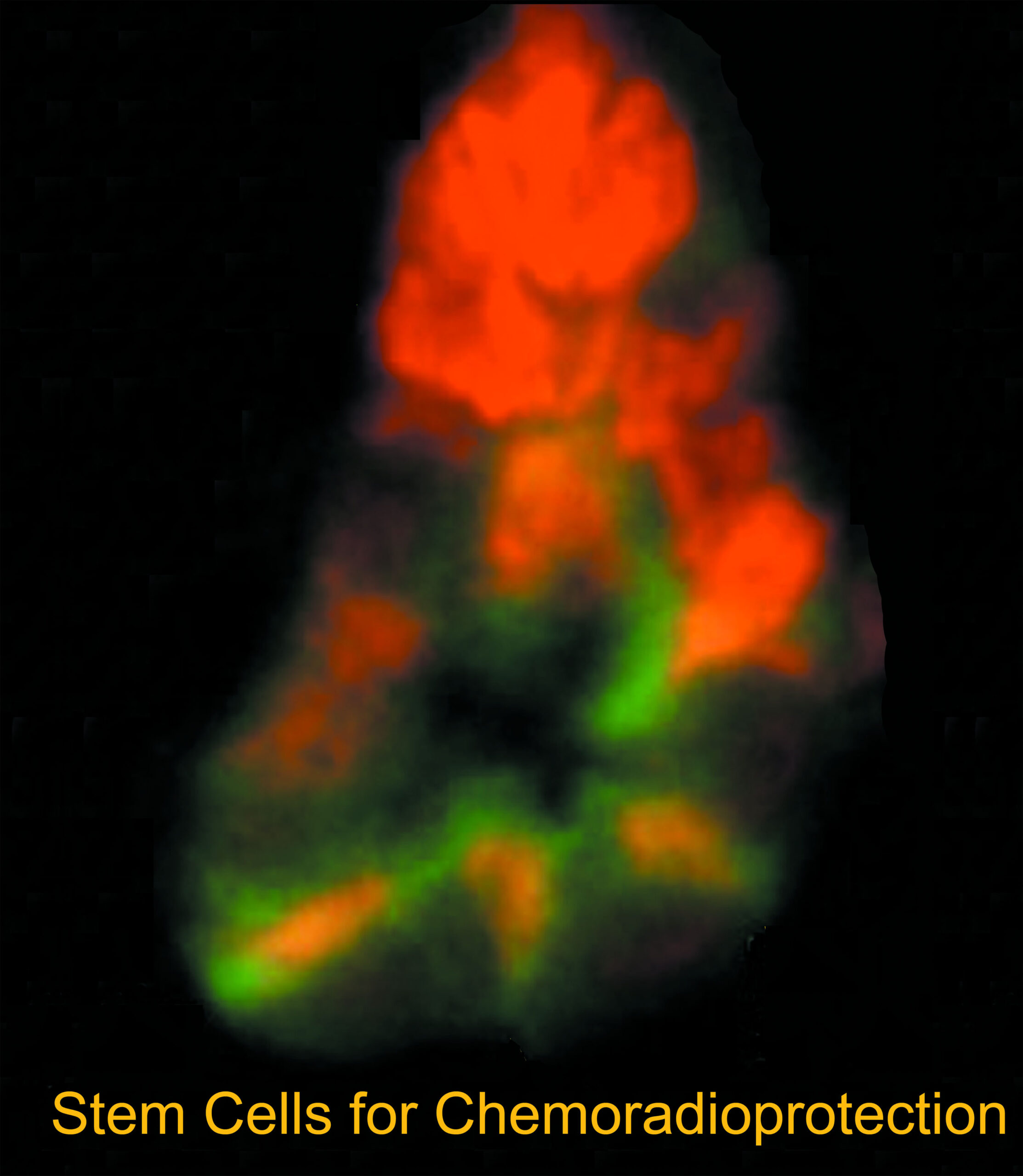 The discovery of Robo1 protein in the intestinal stem cells (depicted in yellow) leads to tolerance of higher doses of chemoradiation in mice. Image courtesy Dr. Wei-Jie Zhou.