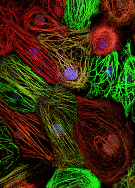 The image from the Bioartography collection shows cells created from "adult" stem cells in the U-M Medical School laboratory of Jack Parent, M.D. Image courtesy of University of Michigan Health System