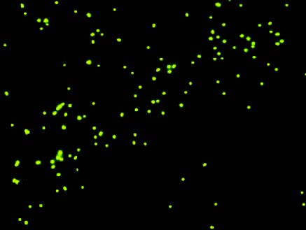 Cancer cells glow green with fluorescent tags.