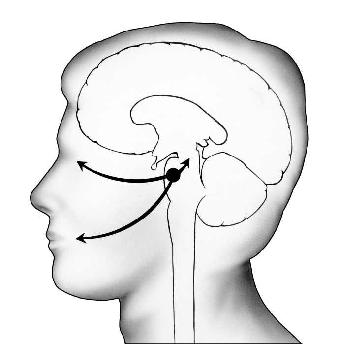 Illustration portraying where herpes type one virus can remain dormant within the brain. Arrows to the eye and mouth indicate some regions where the virus can become active. (stock image)