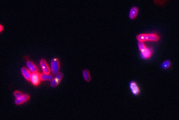 Polyphosphate, colored yellow in this microscopic image, protects bacteria against protein-damaging stress conditions. 