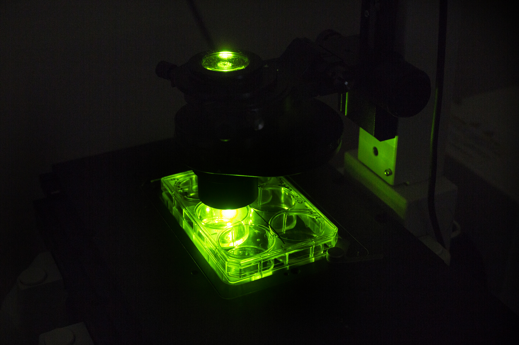Checking for colonies of beating heart muscle cells. Image credit: Joseph Xu