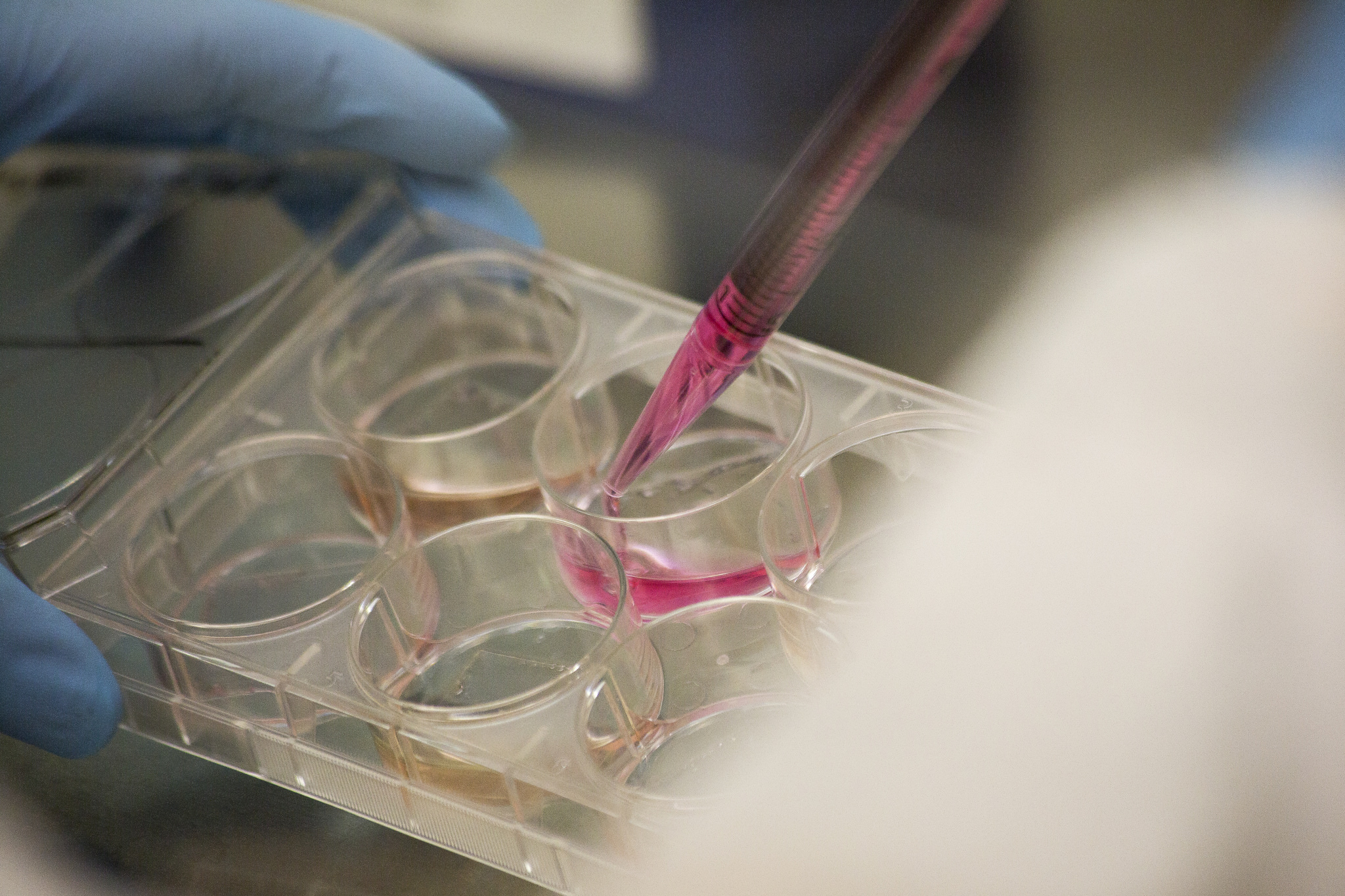 Feeding fibroblast cells different proteins to help transform them into new heart muscle cells. Image credit: Joseph Xu