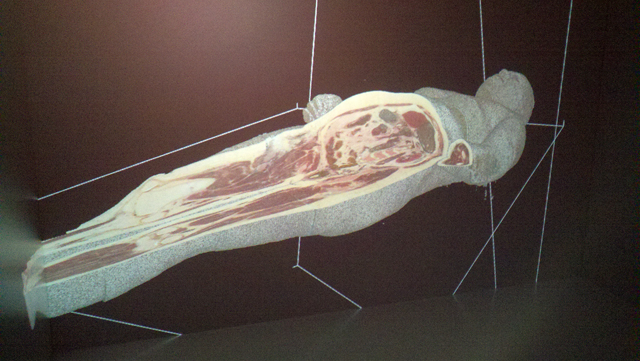 Dental residents virtually dissect this 3D cadaver, which is anatomically correct. Image credit: Laura Bailey