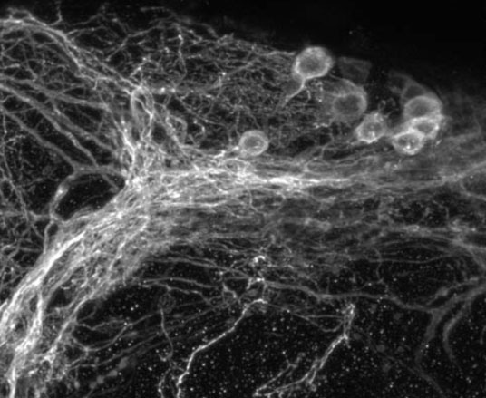 Clock neurons in a small region of the fly brain.