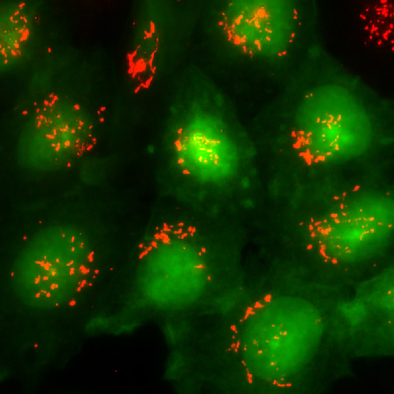 Microscope images of the Golgi structure (red) when fragmented under disease conditions.