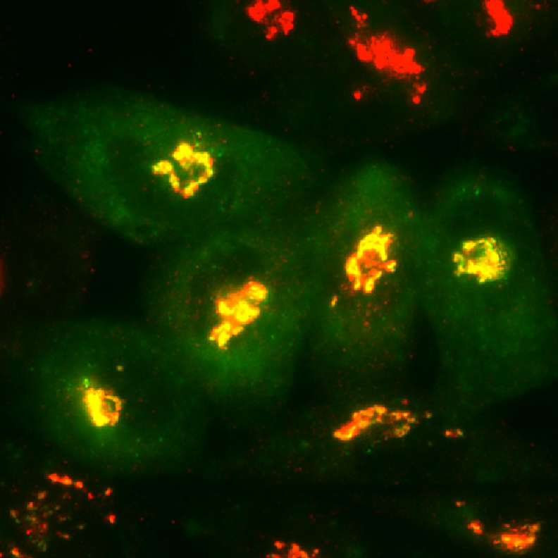 Microscopic images after the researchers restored the Golgi structure (red). Courtesy of principal investigator, Yanzhuang Wang