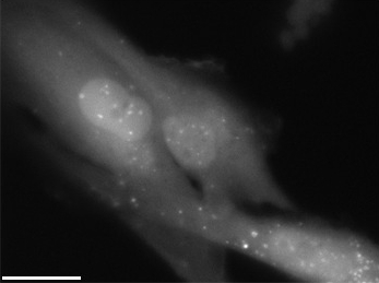 Autophagosomes labeled with a fluorescent marker. Image credit: Wikimedia Commons