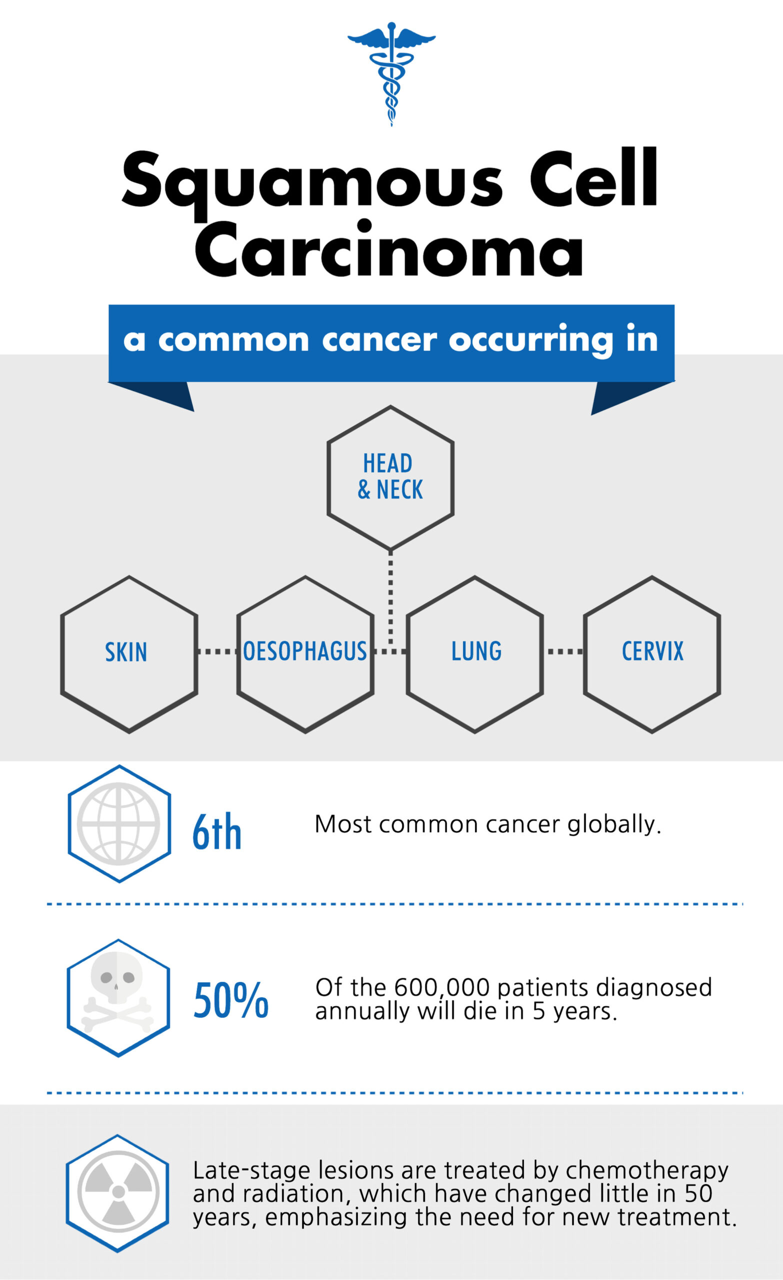 An infographic about squamos cell carcinoma.