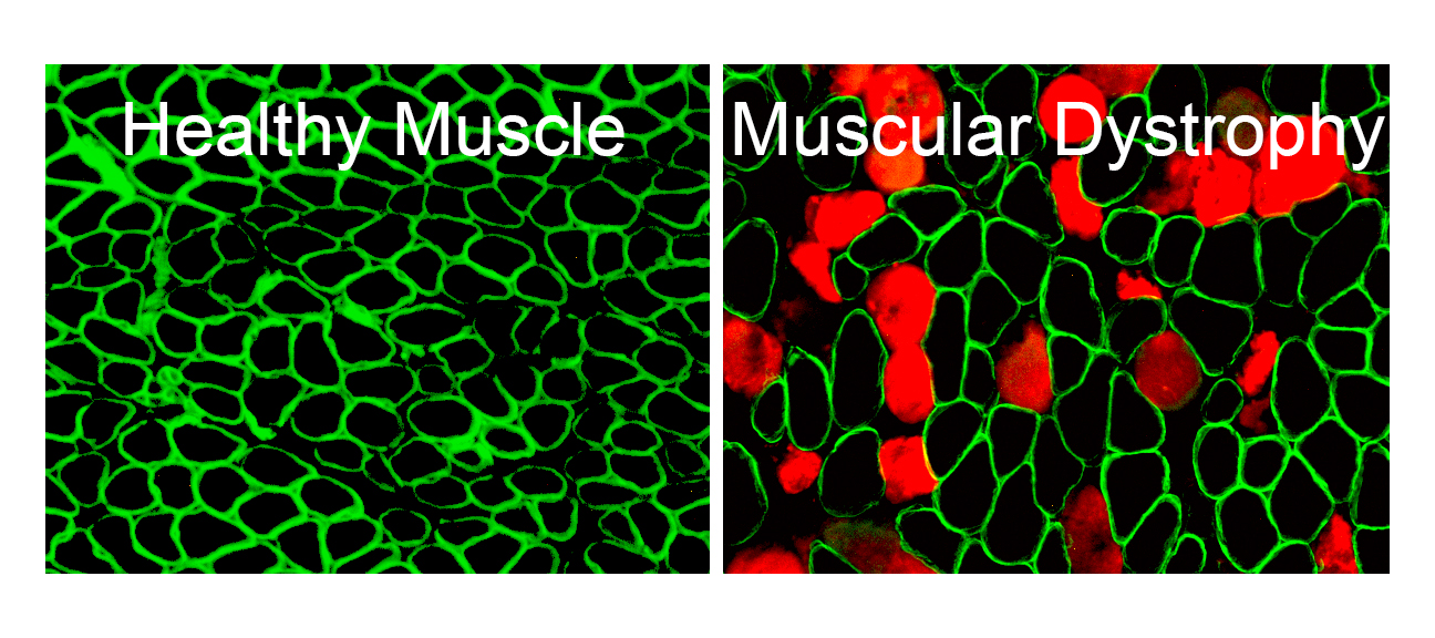 Mice missing a calcium channel TRPML1 develop muscular dystrophy and muscle damage (damaged muscle cells accumulate red-colored Evan Blue dye). Image credit: Xiping Cheng