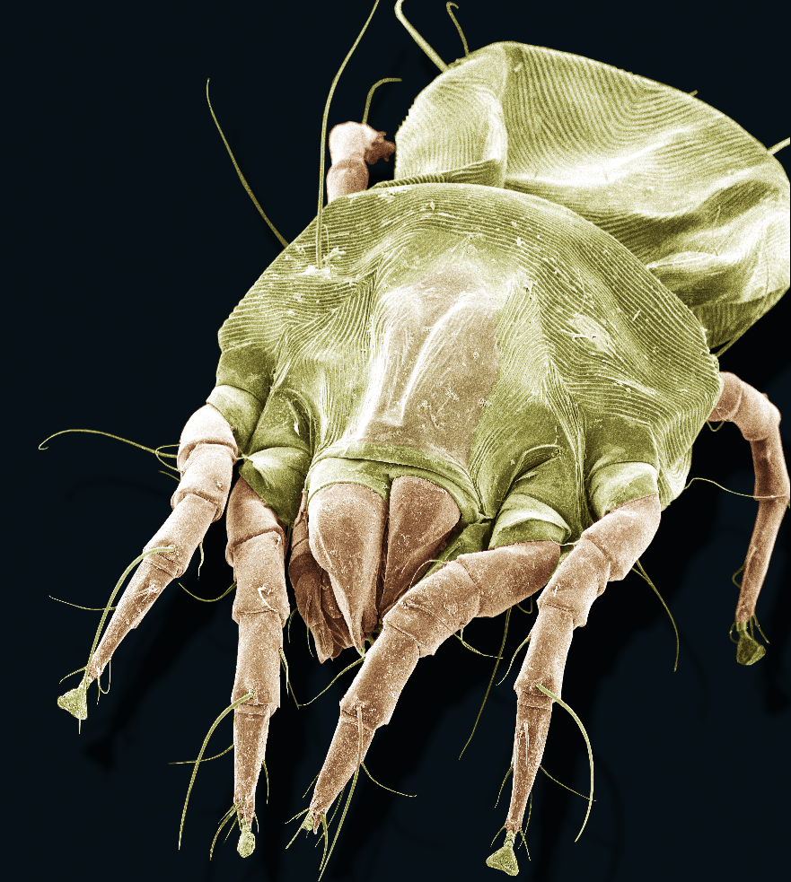 A scanning electron microscope image (magnification X270) of an American house dust mite, Dermatophagoides farinae. Image credit: Ellen Foot Perkowski