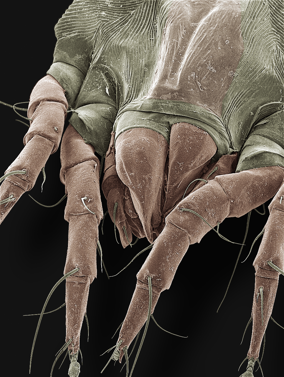A scanning electron microscope closeup (magnification X550) of an American house dust mite, showing four of its eight legs, as well as the mouthparts. Image credit: Ellen Foot Perkowski