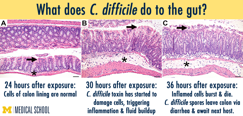 Illustration depicting C. difficile's effect on the gut at 24, 30, and 36 hours of exposure
