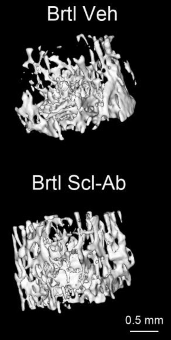 Three-dimensional images of bone from mice with genetic features that mimic brittle bone disease. The top image shows bone before treatment with a sclerostin antibody. The bottom image shows the same bone after five weeks of treatment. Image credit: University of Michigan Health System
