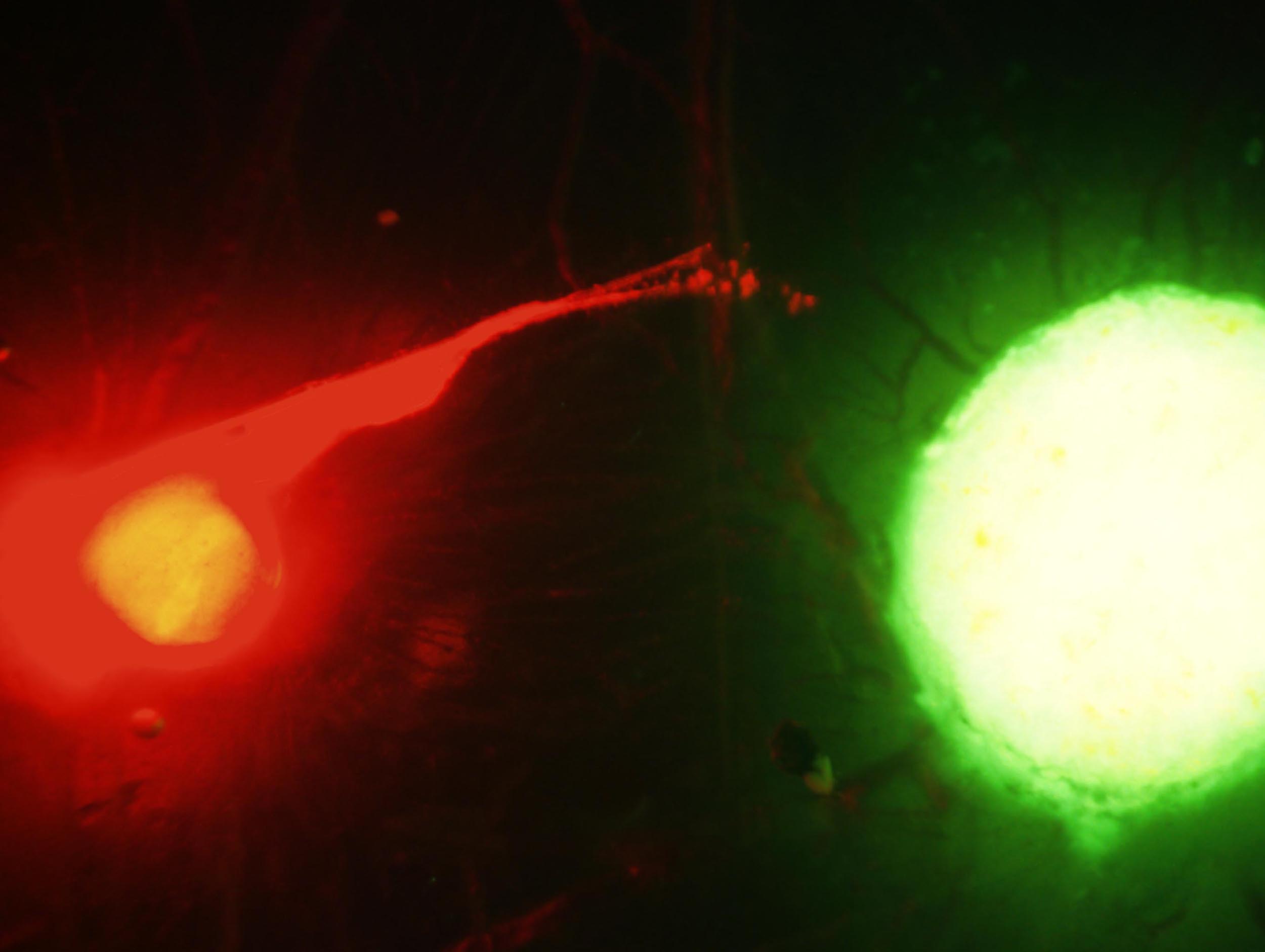 The fluorescence image shows the interaction between the nerve (red) and cancer (green). Image credit: Nisha D’Silva
