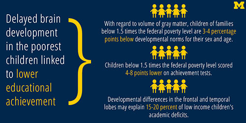 Brain drain graphic