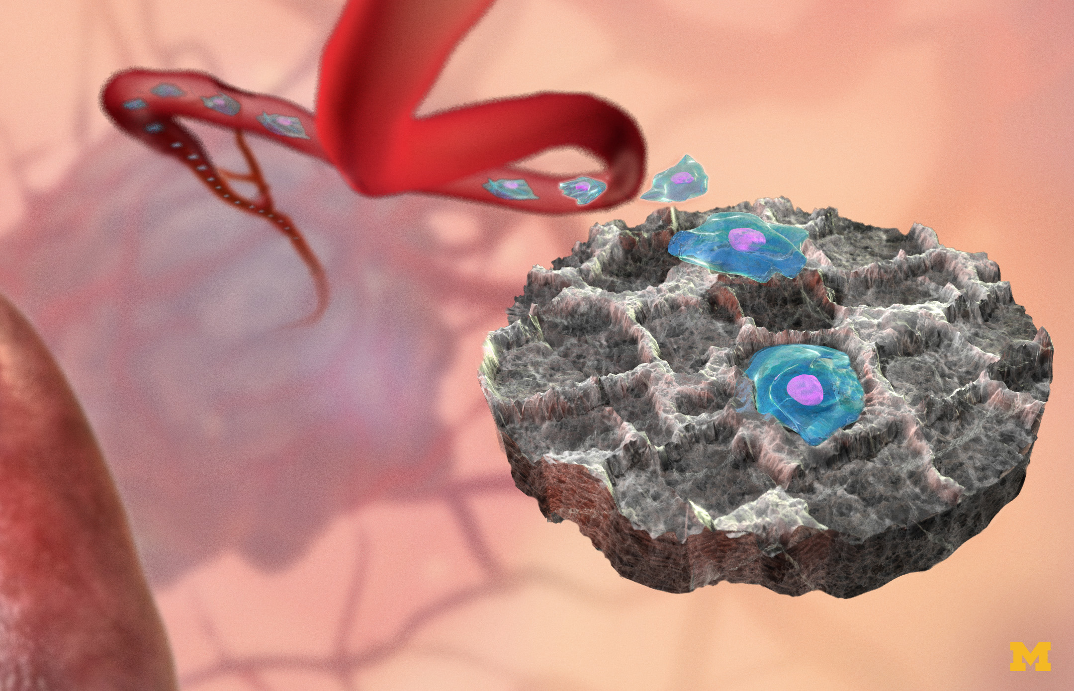 Conceptual illustration of implantable sponge-like device attracts cancer cells from the bloodstream.