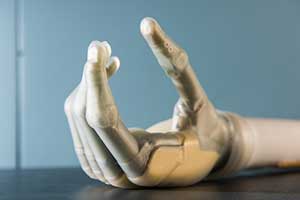 Prosthetic hand