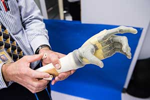 Electrodes and prosthetics