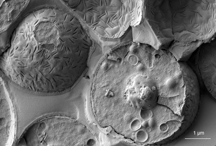 Baker's yeast (Saccharomyces cerevisiae). Image credit: Prof. Dr. Gerhard Wanner, LMU Munich, Faculty of Biology.