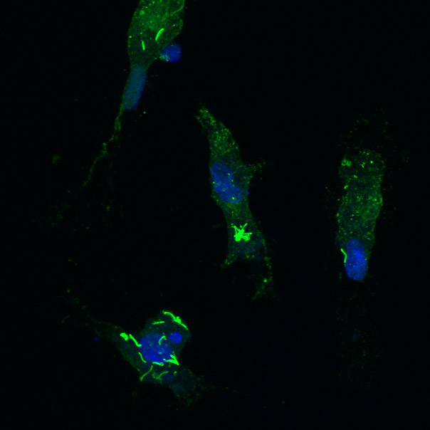 Tuberculosis bacteria (bright green) that have hijacked the white blood cells of a macaque monkey. Image credit: Flynn Lab, University of Pittsburgh