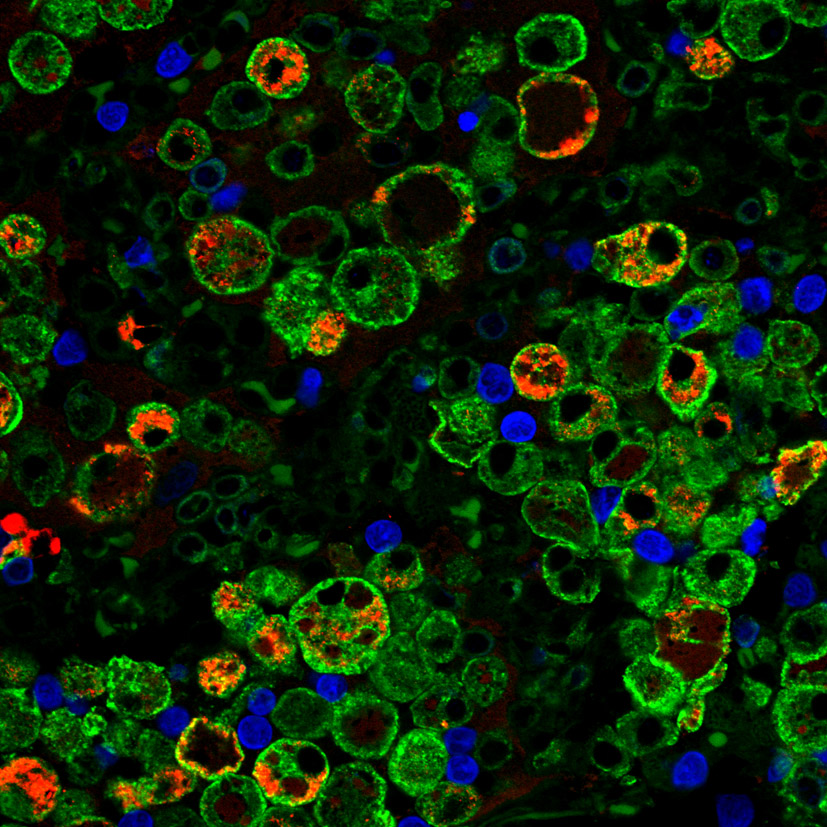 White blood cells collected in granulomas. Image credit: Flynn Lab, University of Pittsburgh