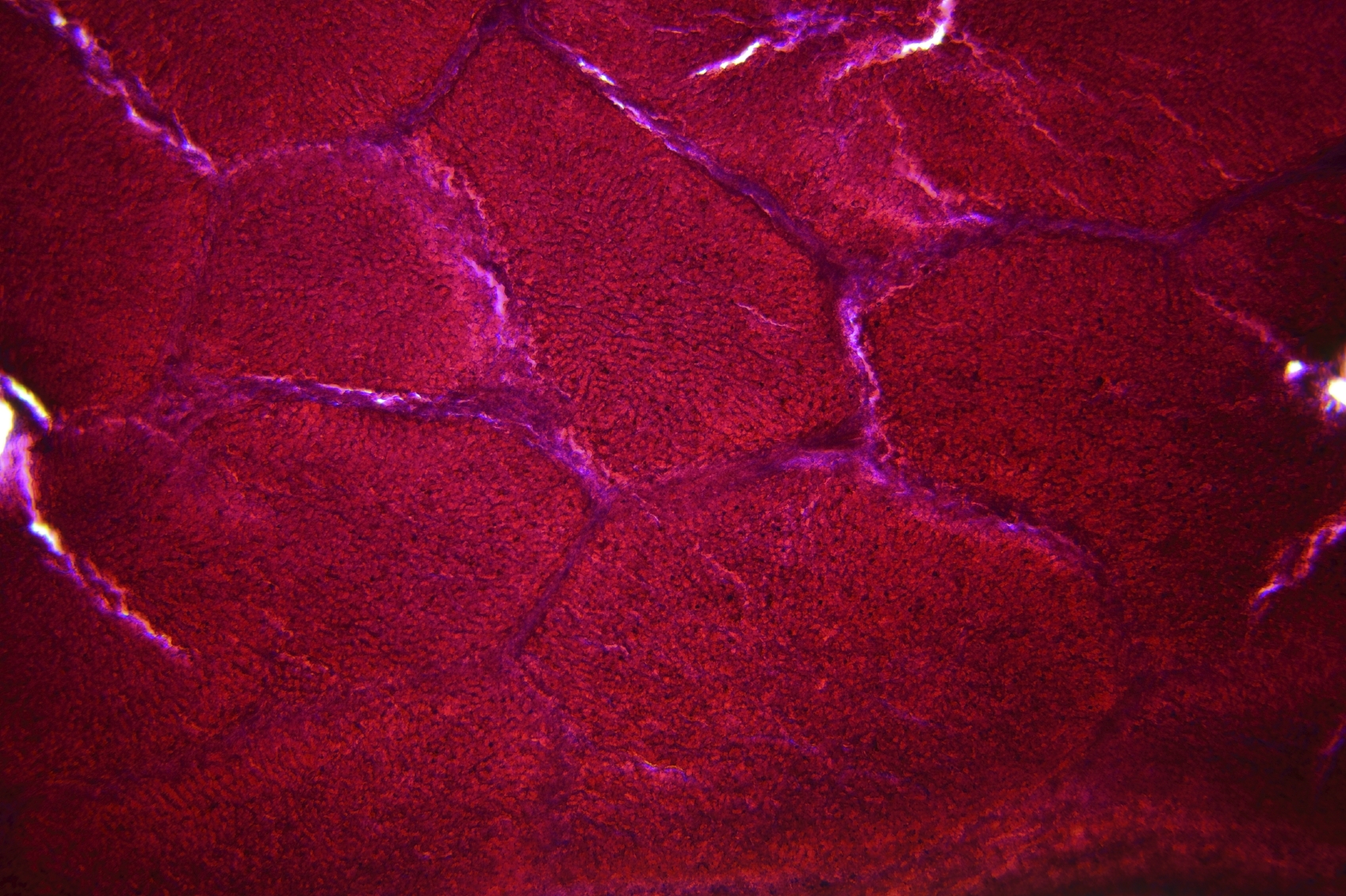 Liver cells under the light microscope. (stock image)