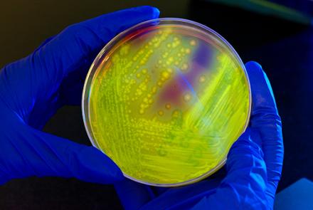  C. difficile bacteria growing in a Petri dish, glowing under long-wave ultraviolet light. (stock image)