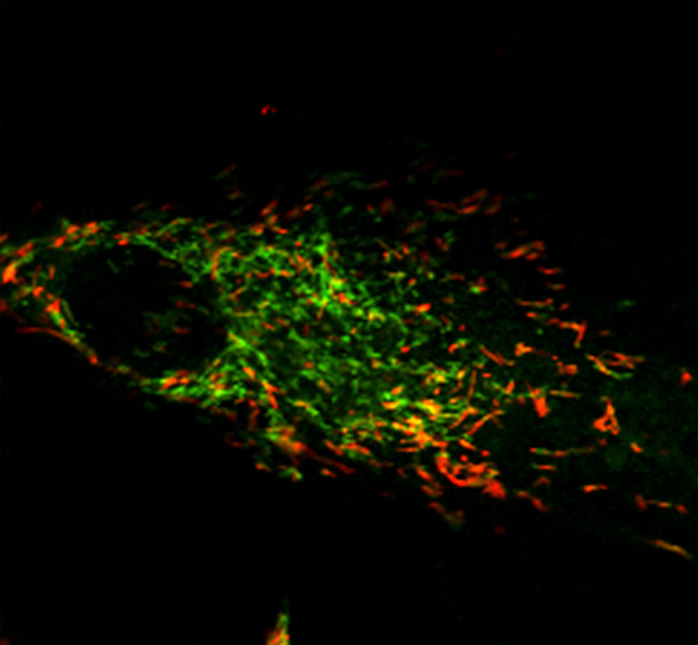Green dye indicates damaged mitochondria that cannot be removed in due to impaired ROS sensing mechanisms.