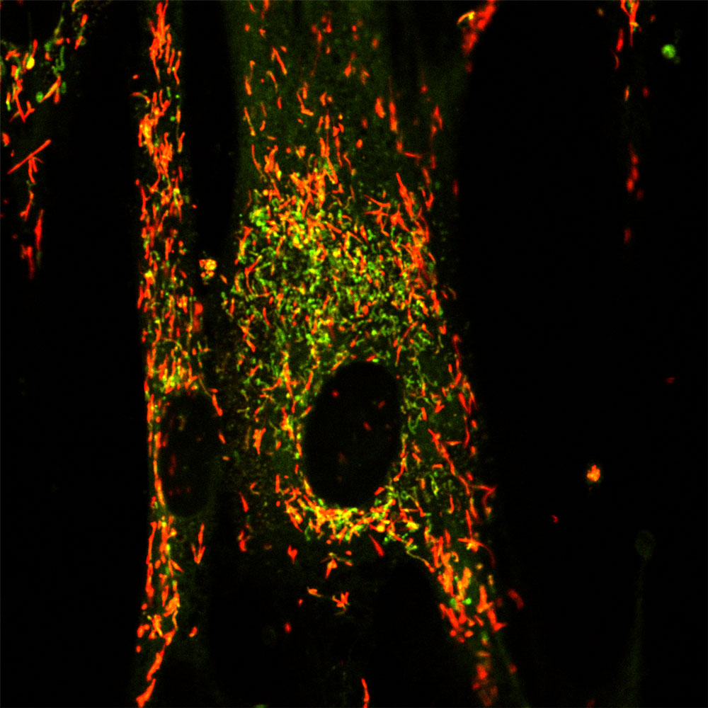 The red dye in the cell show healthy mitochondria in a healthy cell. Images provided by Haoxing Xu