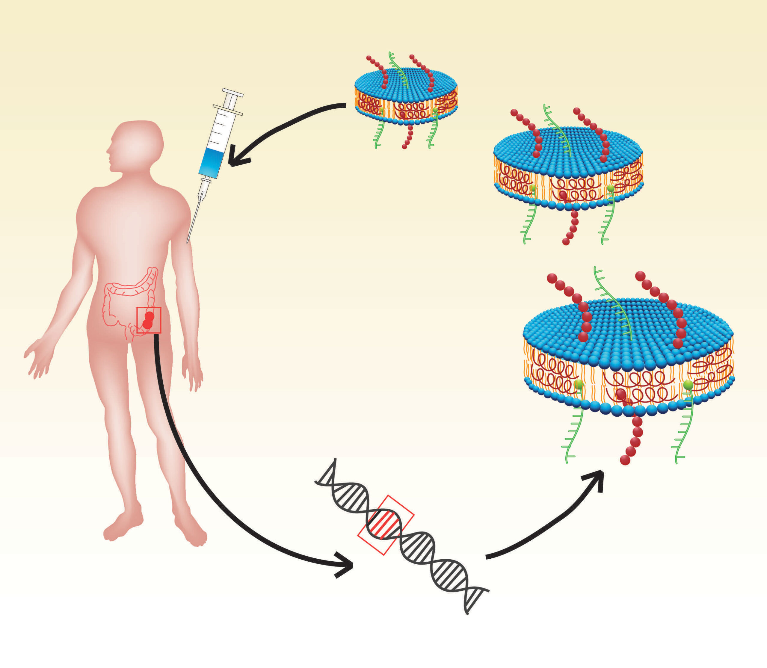 The therapeutic cancer vaccine employs nanodiscs (in blue) loaded with tumor neoantigens, which are unique mutations from the patient's own tumor cells. By generating T-cells to recognize the neoantigens, the nanodiscs can target a patient’s cancer mutations and fight to eliminate cancer cells and prevent tumor growth. Image credit: James Moon, John Gideon Searle