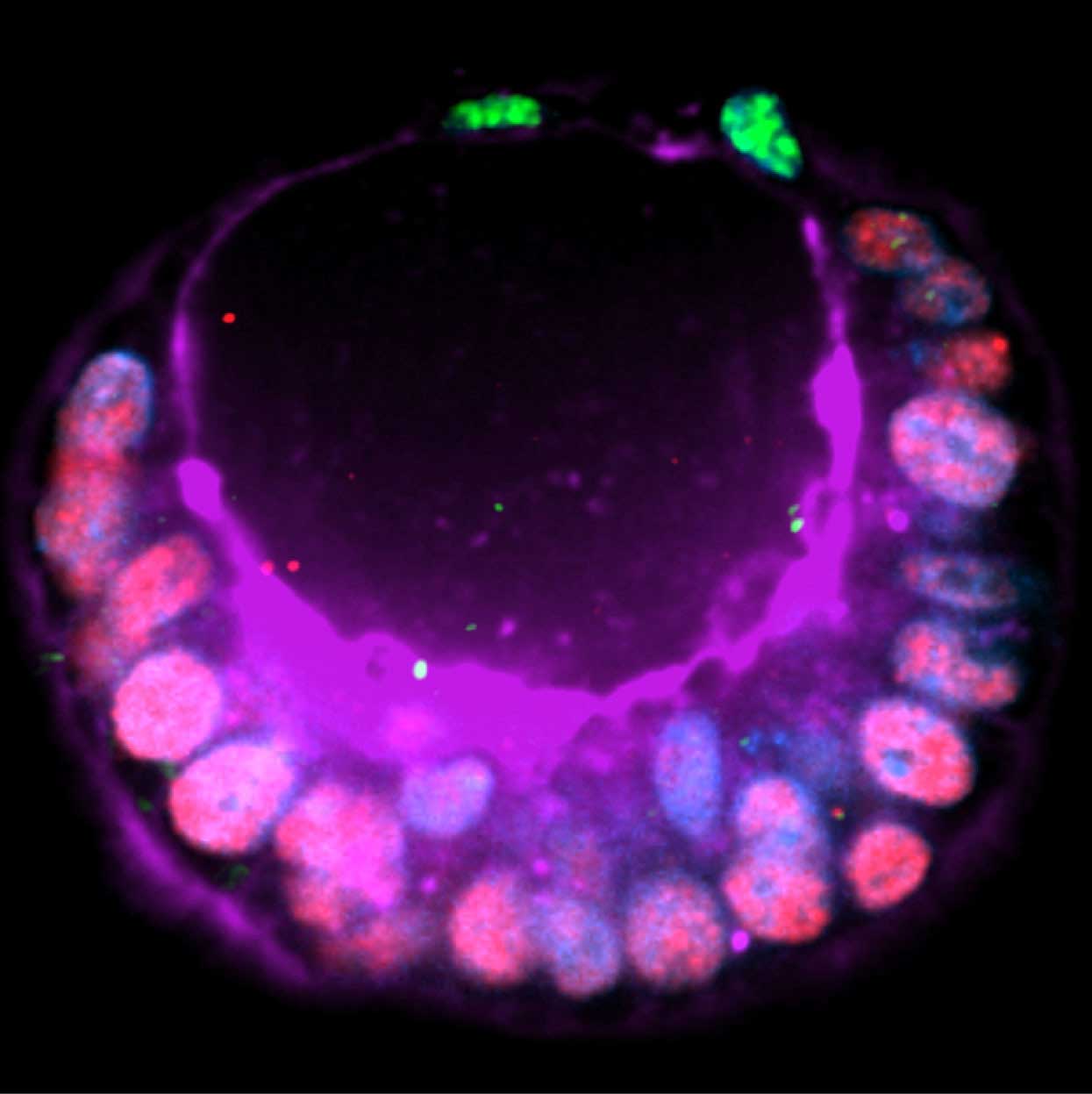 The PASE, or post-implantation amniotic sac embryoid, is a structure grown from human pluripotent stem cells that mimics many of the properties of the amniotic sac that forms soon after an embryo implants in the uterus wall. The structures could be used to study infertility. Image credit: Michigan Medicine