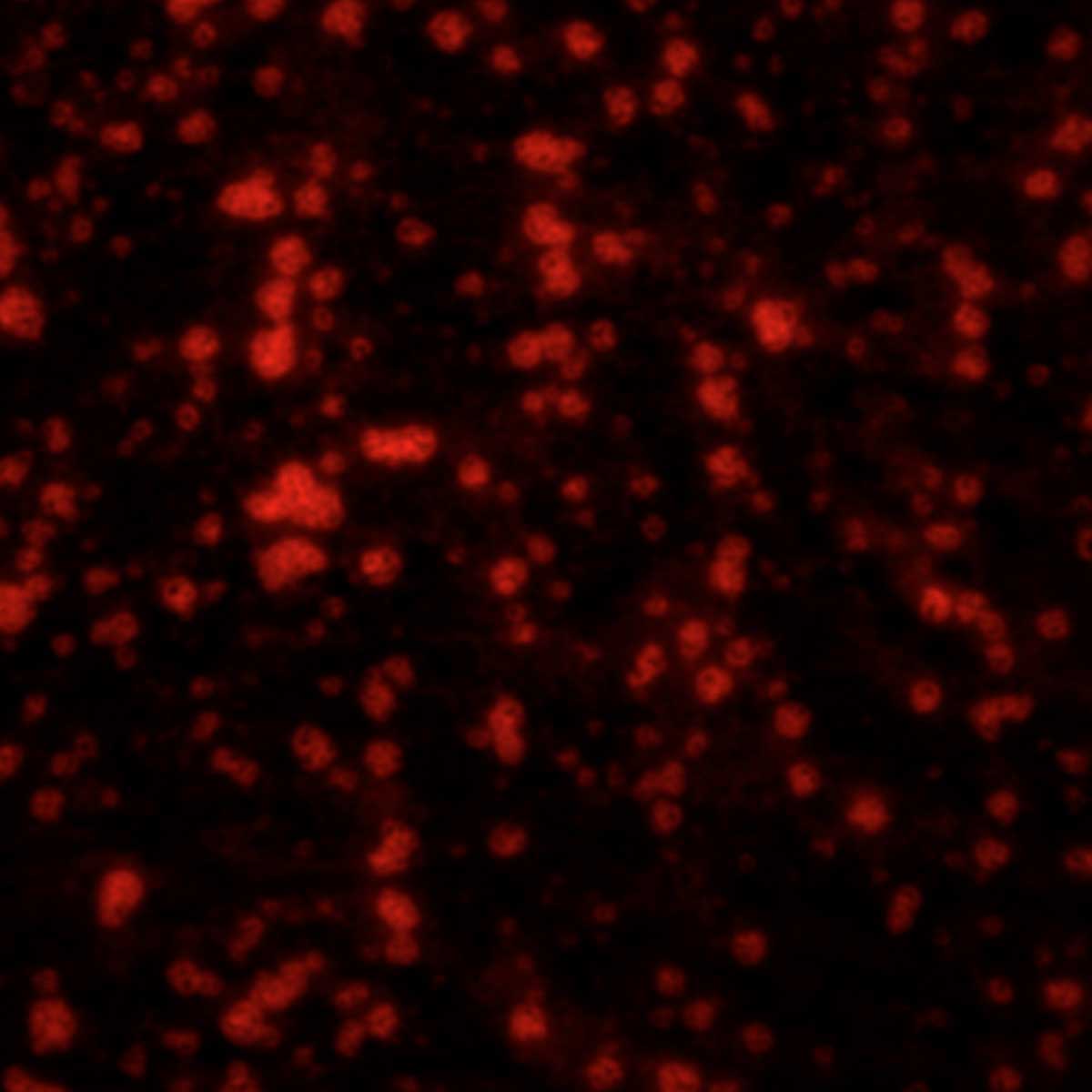 Vesicles containing the phospholipid DMPE-rhodamine B after Ramamoorthy's polymer has been added. Phospholipids are fatty acids that are critical components of all cell membranes. The polymer breaks the vesicles to form sushi-like nanodiscs. Image courtesy: Ayyalusamy Ramamoorthy