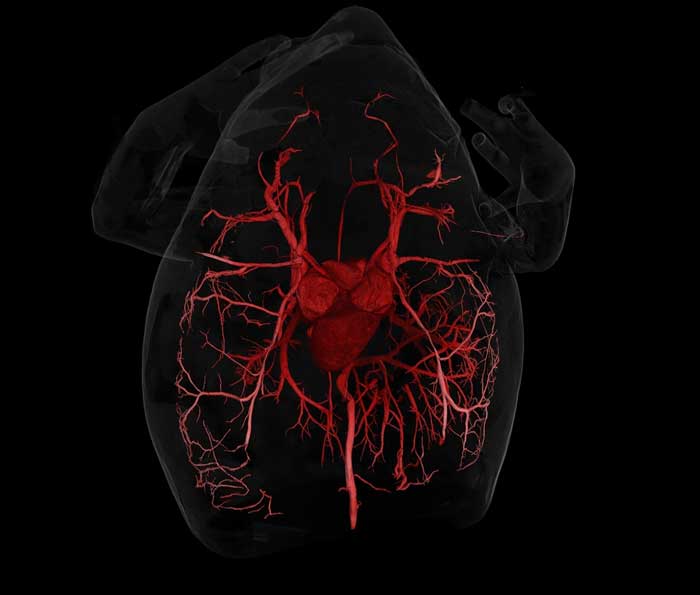 CT scan showing the circulatory system of Hypopachus variolosus, the Mexican narrow-mouthed toad. Images credit: Ed Stanley, Florida Museum of Natural History
